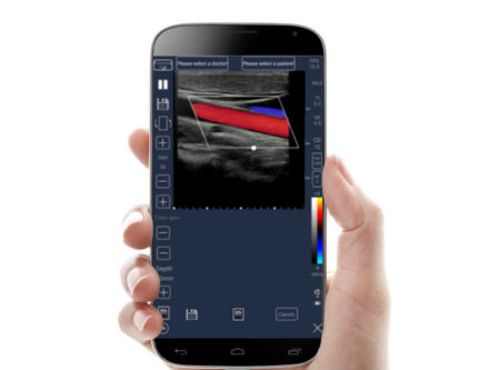 Portable Ultrasound Machine C-Scan Meditech