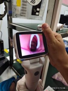 Postman Optical & Laryngoscope Device